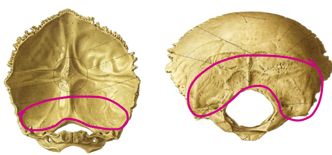 term image