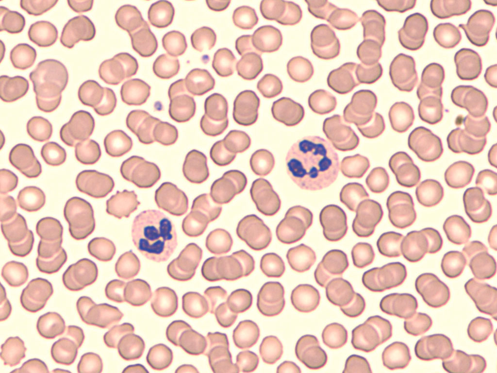 <p>what is the <strong>percentage of leukocytes</strong> in <strong>neutrophils</strong> </p>