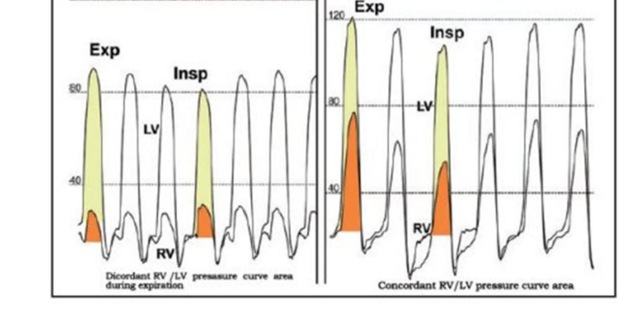 <p>What wave form are these two </p>