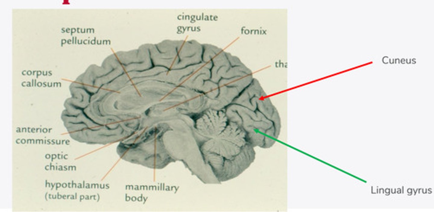 <p>In the midsaggital view, the occipital lobe is divided in half by what? What 2 lobes does it divide into?</p>