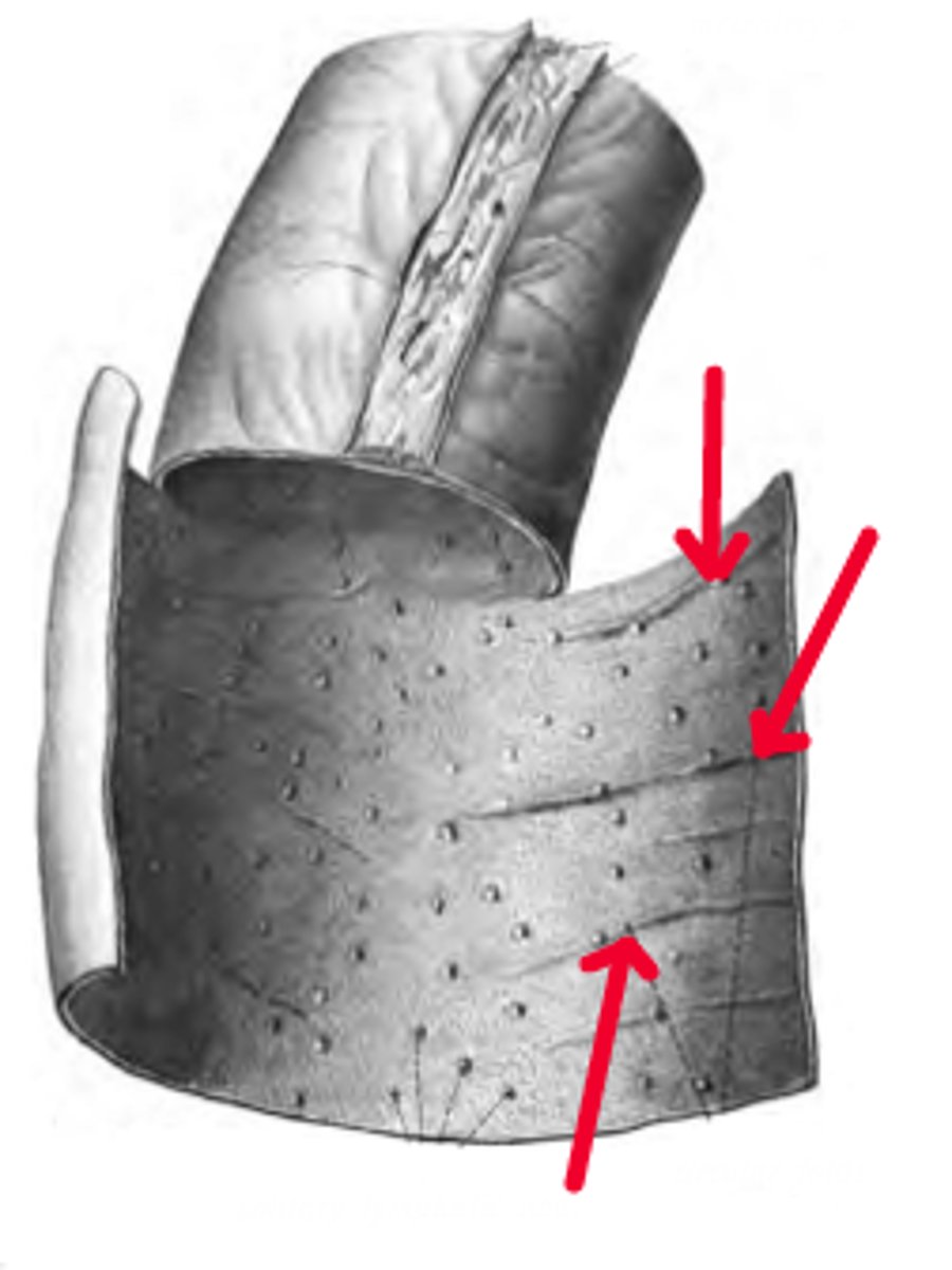 <p>What is the name for the folds in the small intestine? These are also known as circular folds.</p>