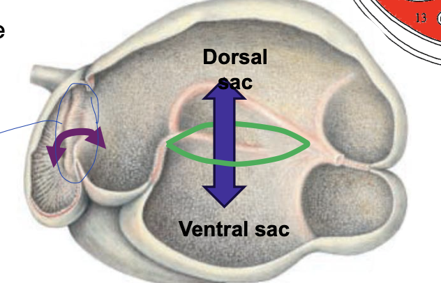 <p>what is the purple arrow showing?</p>
