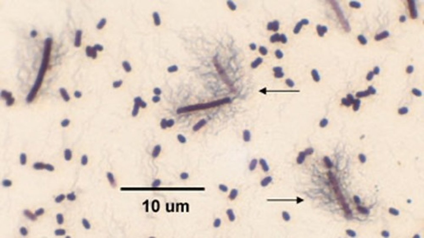 <p>what type of stain is this?</p>
