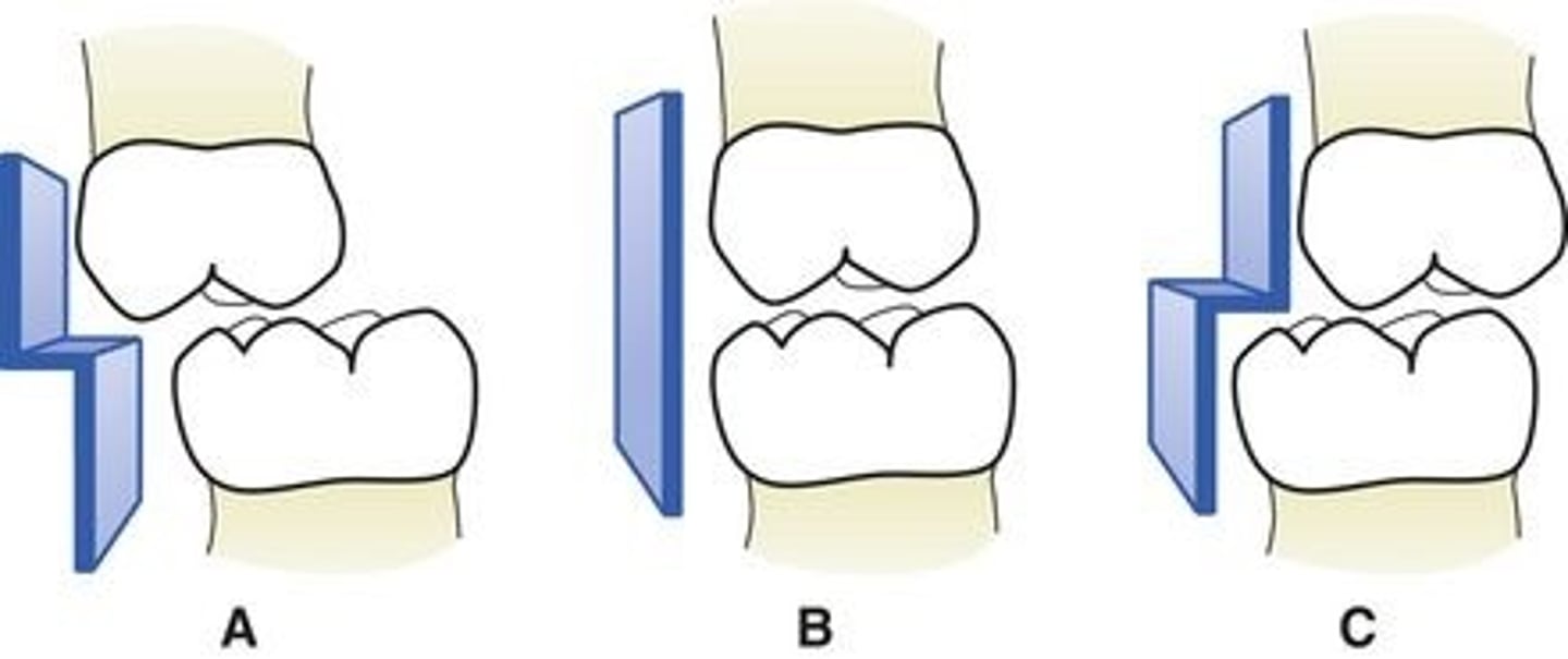 <p>end to end occlusion</p><p>(Picture: B)</p>
