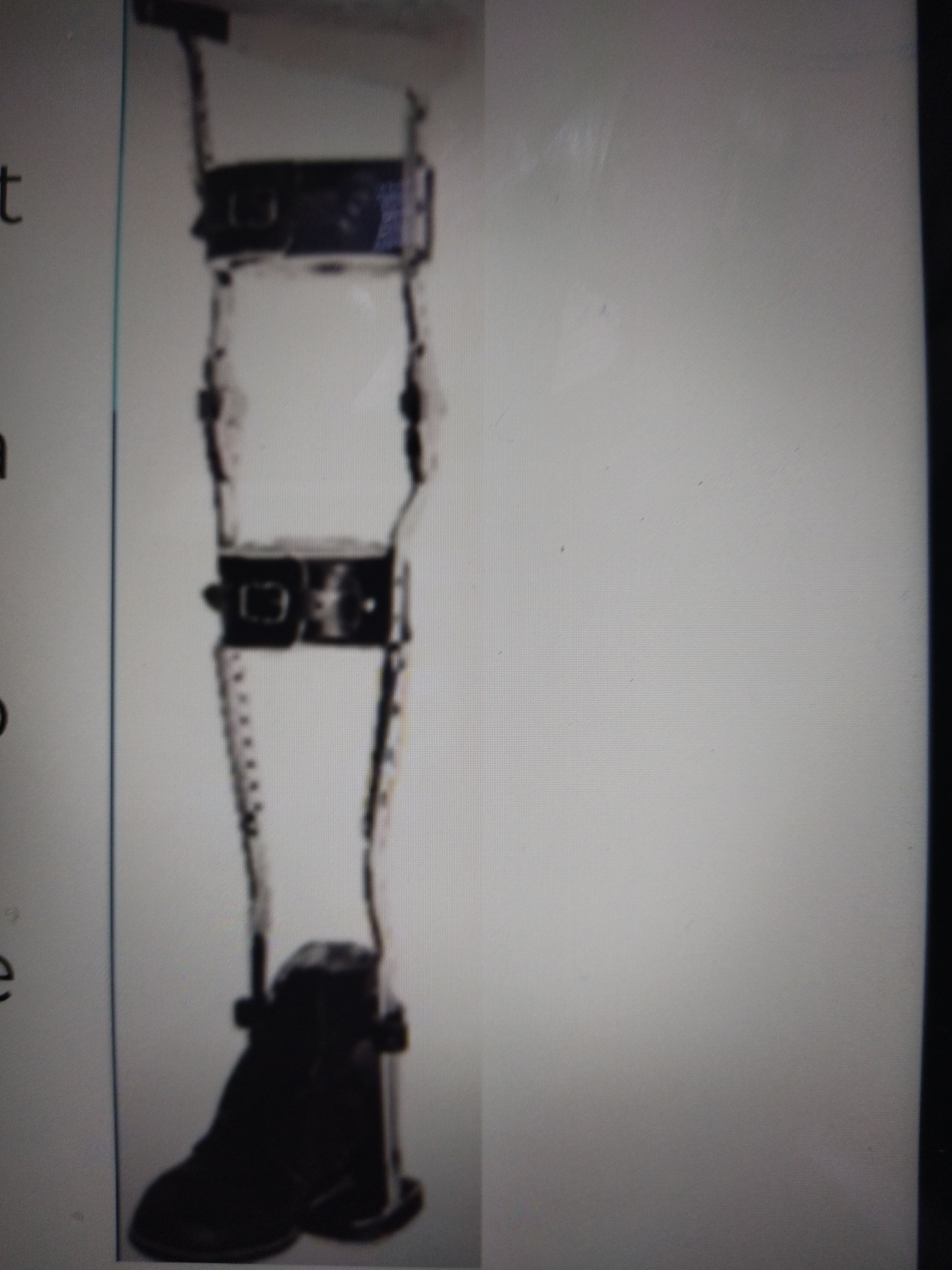 * Reduces weight bearing of the whole LE
* Total elimination of weight bearing of the whole limb