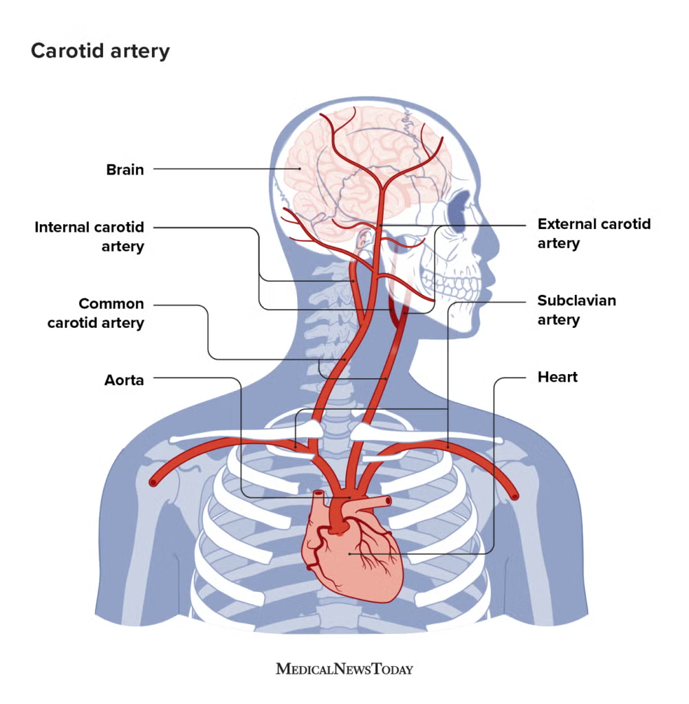 <p>T/F The internal carotid artery</p><p><strong>F -</strong> A. enters the skull through the foramen lacerum</p><ul><li><p>passes <strong>over</strong> the foramen lacerum</p></li><li><p>enters the skull via the <strong>carotid canal</strong></p></li></ul><p><strong>T -</strong> B. divides into the anterior and middle cerebral arteries</p><p><strong>T -</strong> C. gives off the ophthalmic artery</p><p><strong>F -</strong> D. is accompanied within the skull by preganglionic sympathetic nerve fibres</p><ul><li><p>accompanied by <strong>postganglionic</strong> sympathetic fibres</p><ul><li><p>from the <strong>superior cervical ganglion</strong></p></li></ul></li></ul><p><strong>F -</strong> E. usually begins about the level of the cricoid cartilage.</p><ul><li><p>begins at the level of the upper border of the thyroid cartilage (higher than cricoid)</p></li></ul><p></p>