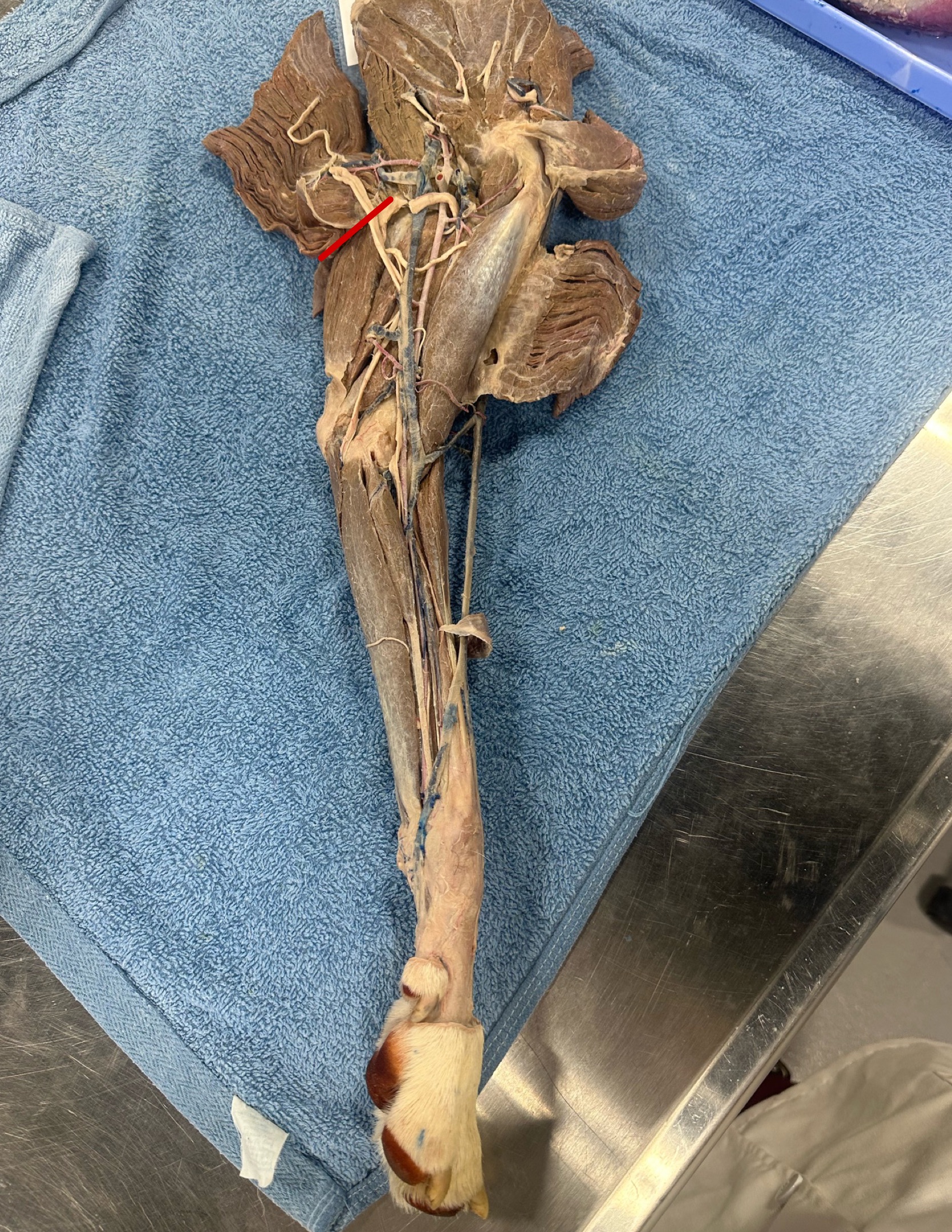 <p>When performing a dissection you accidentally cut the labeled nerve/nerves</p><ul><li><p>what is this nerve/nerves</p></li><li><p>What spinal nerves do these originate from </p></li><li><p>name 3 muscles that are now paralyzed </p></li><li><p>are these sensory, motor, or both? </p></li></ul><p></p>