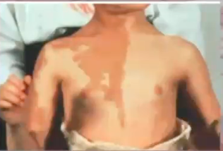 <p>diagnosis?</p>