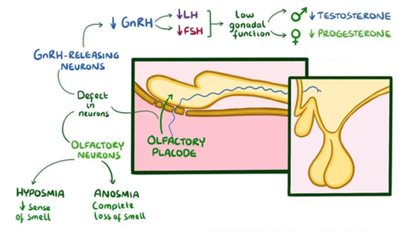 <p>hypoplastic ONH</p><p>anosmia</p><p>forebrain anomalies</p><p>gonadotropin deficiency = delayed puberty, amenorrhea</p>