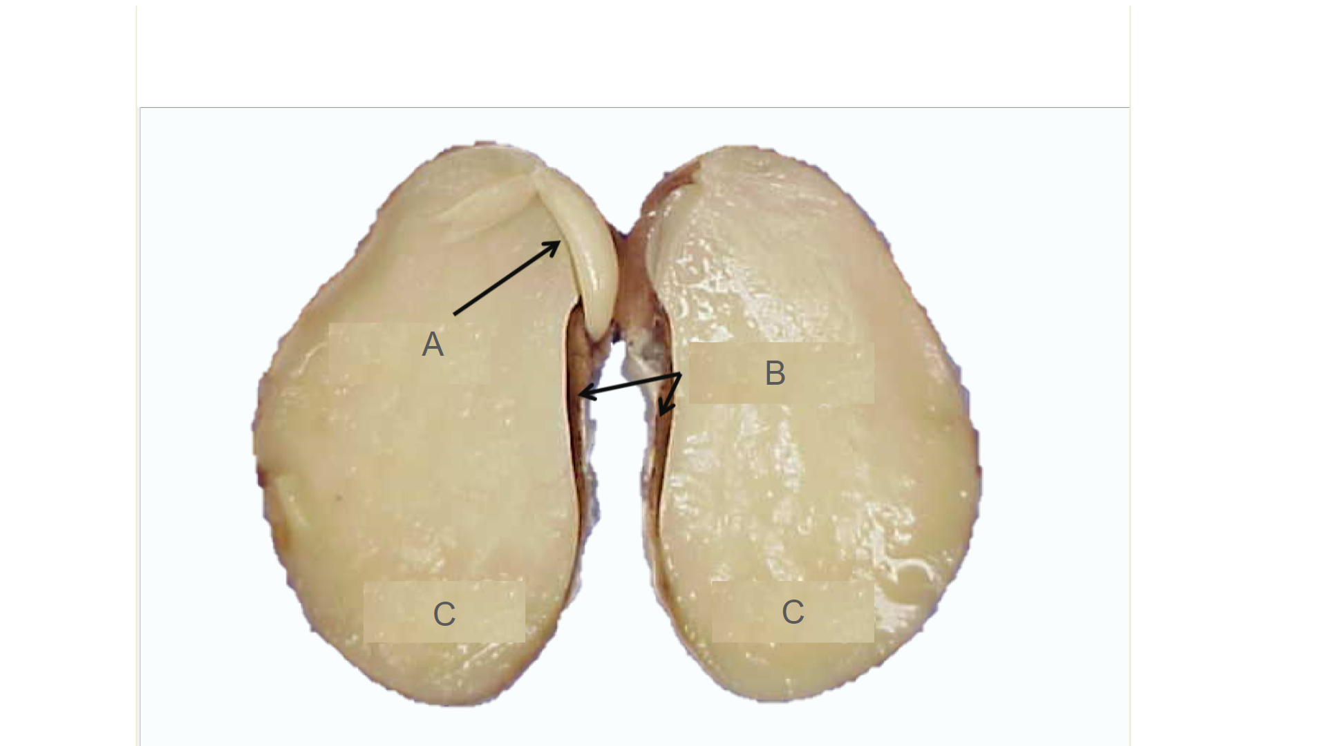 <p>What is B?</p>