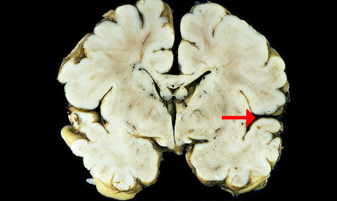 <p>Label this brain structure</p>