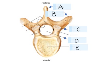 <p>what kind of bone is this?</p>