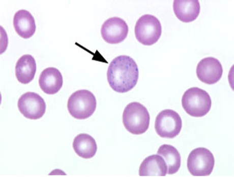 <p><u>Small dark blue dotlike</u> structures scattered fairly uniformly throughout the RBC</p><p>Derived from ribonucleoprotein and mitochondrial remnants</p>
