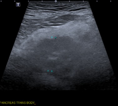 <p>ultrasound</p>
