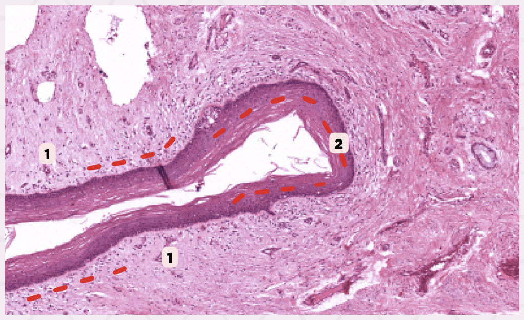 <p>Identify the structure labeled as 2.</p>
