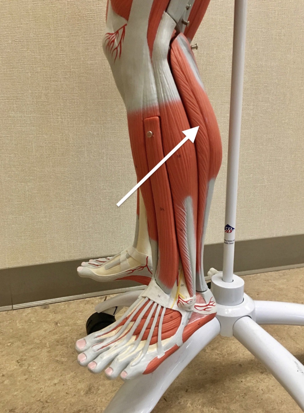 <p><span>Name the muscle labeled with the white arrow below:</span></p>