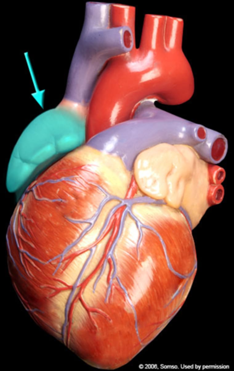 <p>What part of the heart is this?</p>