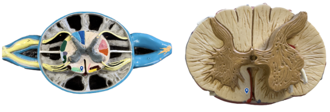 <p>What area of white matter is the arrow pointing to?</p>