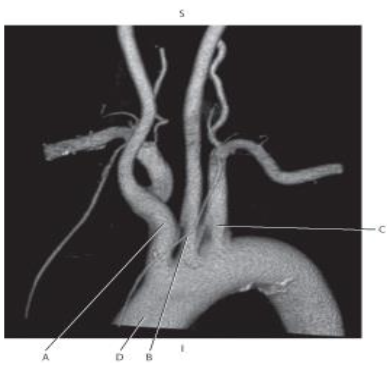 <p><mark data-color="yellow">Which line points to ascending aorta?</mark></p>