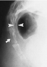 <p>Q what is the name of this measurement? and what is the average + range?</p>