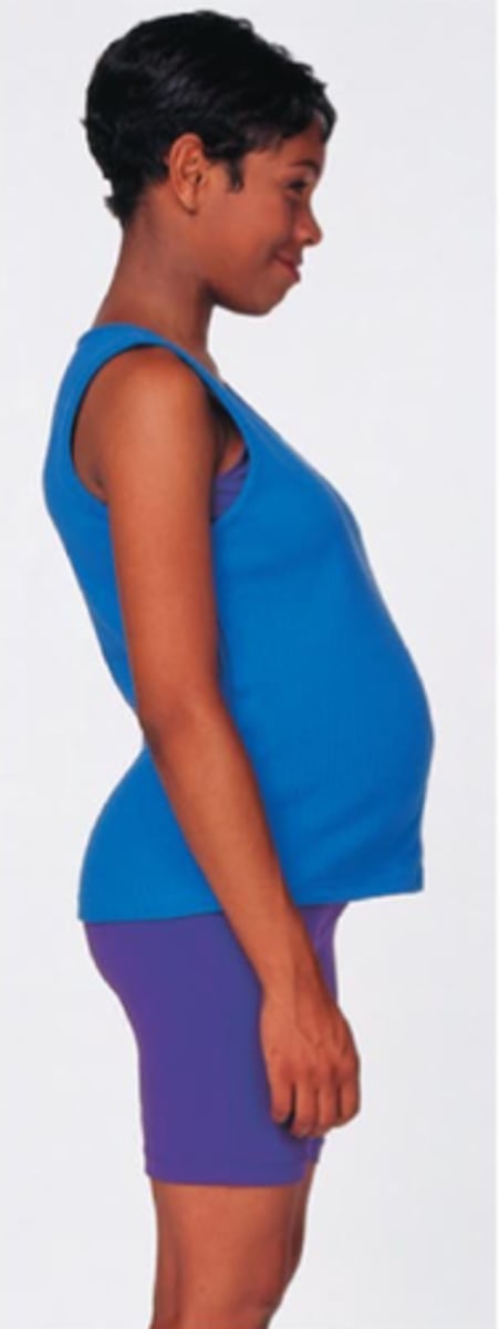 <p>accentuated lumbar curvature</p>