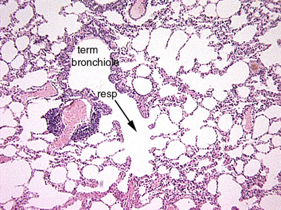 <p>Identify the terminole bronchiole, respiratory bronchiole, aveolar duct, alveolar sac and alveoli.</p>