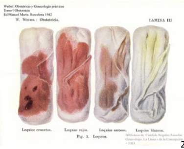 <p>shrinkage of the uterus in the first 6 weeks postpartum</p><ul><li><p>Loses 50% of its weight in the first week</p></li><li><p>Involution is achieved by autolysis (self-digestion) of uterine cells by their own enzymes</p></li><li><p>For about 10 days, the mother produces a vaginal discharge, called lochia </p><ul><li><p>is bloody at first and then turns serous (clear)</p></li></ul></li></ul><p></p>