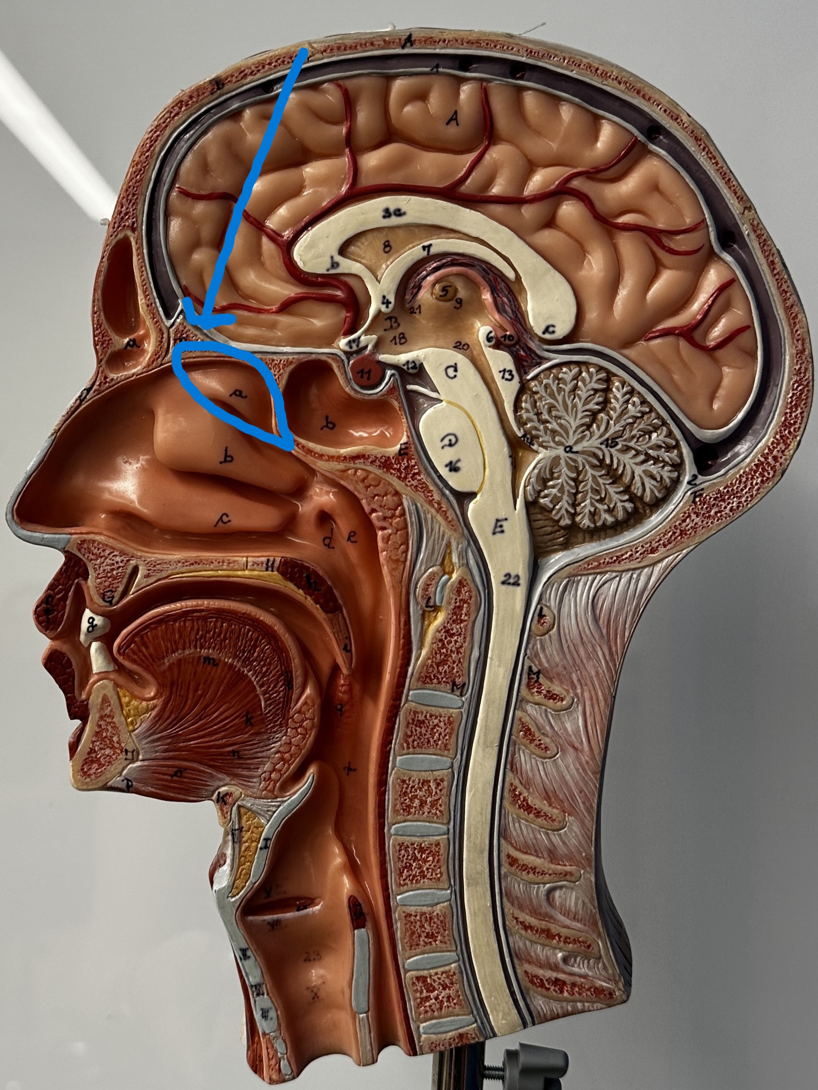 term image