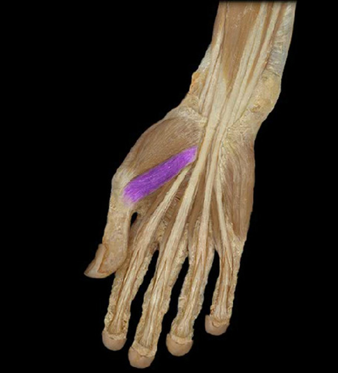 <p>base of proximal phalanx of thumb</p>