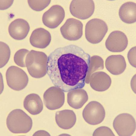 <p>What is this leukocyte?</p>