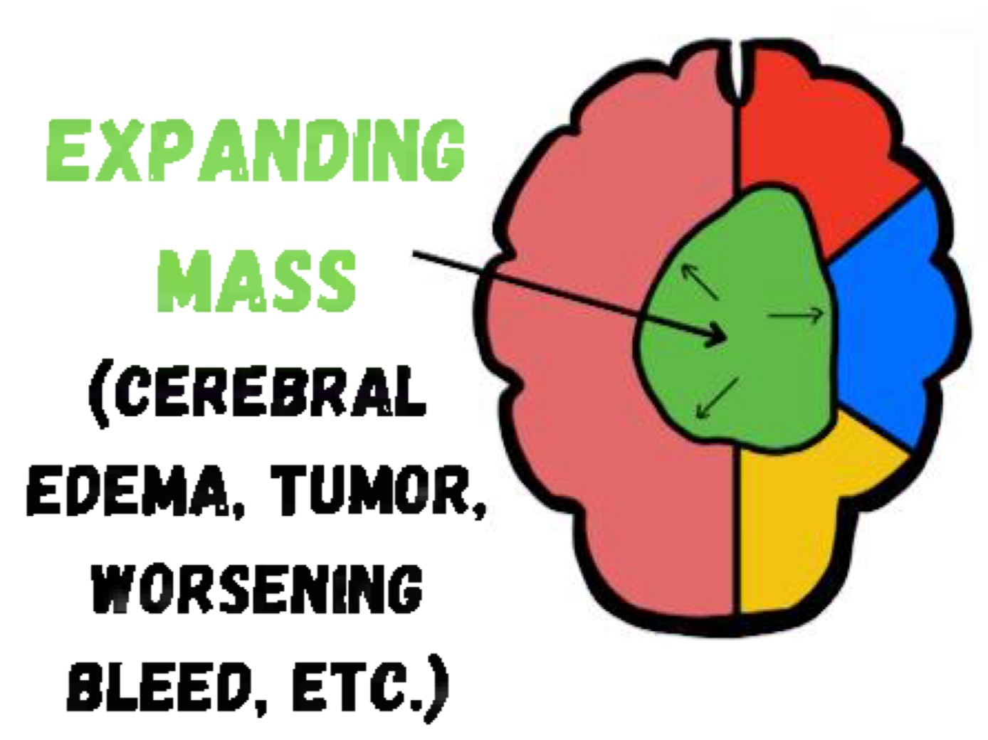<p><strong><u>limit of displacement</u></strong> of CSF &amp; blood has been reached</p><p></p><p>volume of mass reaches critical threshold (rapid increase in ICP) → can lead to <strong>reduction or cessation of cerebral blood flow &amp; herniation risk </strong></p>
