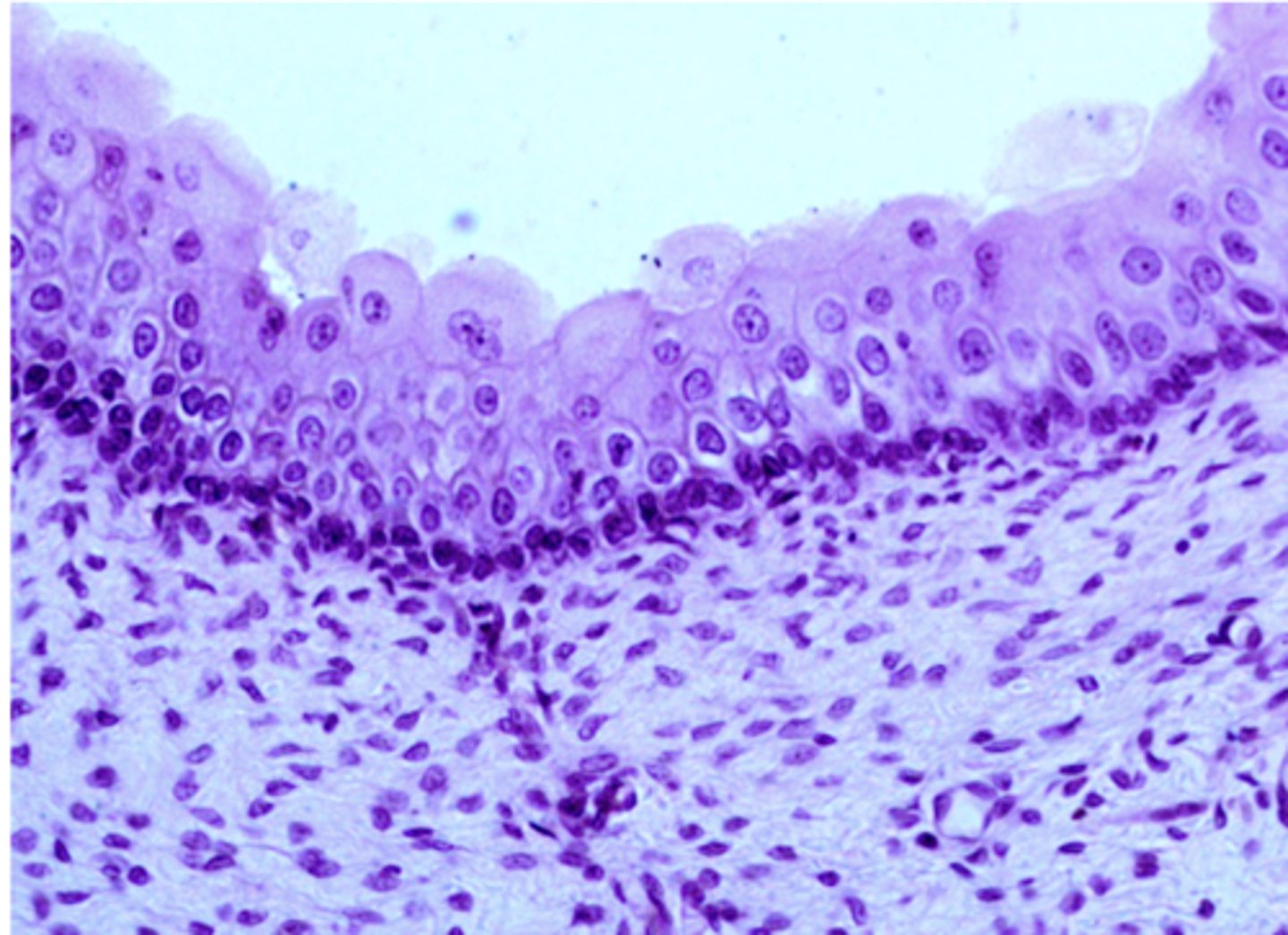 <p>what type of epithelium is shown</p>