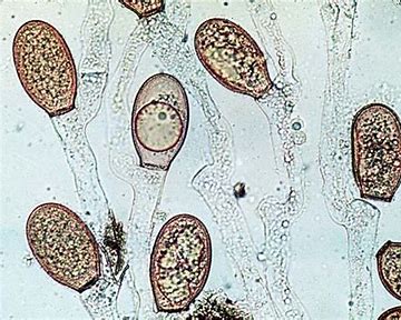 <p>Chytridiomycota</p>