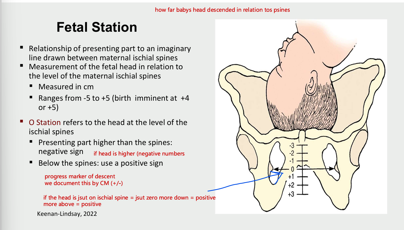 <ul><li><p>relationship of presenting part ot an imaginary line drawn between maternal ischial spines&nbsp;</p></li><li><p>measurement of fetal head in relation to level of maternal ischial spines</p><ul><li><p>measure in cm</p></li><li><p>ranges form -5 to +5 (birth imminent at +4 or+5)</p></li></ul></li><li><p>O station refers to the head at the level of the ischial spines</p><ul><li><p>presenting part higher than the spines: negative sign (if head is higher negatives</p></li><li><p>below the spines - positive sign</p></li></ul></li></ul><p></p>