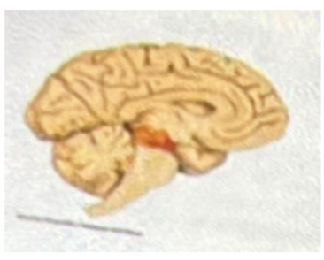 <p><strong>The colored region below is the</strong></p><p>A- Pons </p><p>B- thalamus </p><p>C- hippocampus </p><p>D- medulla </p><p>E- Midbrain</p>