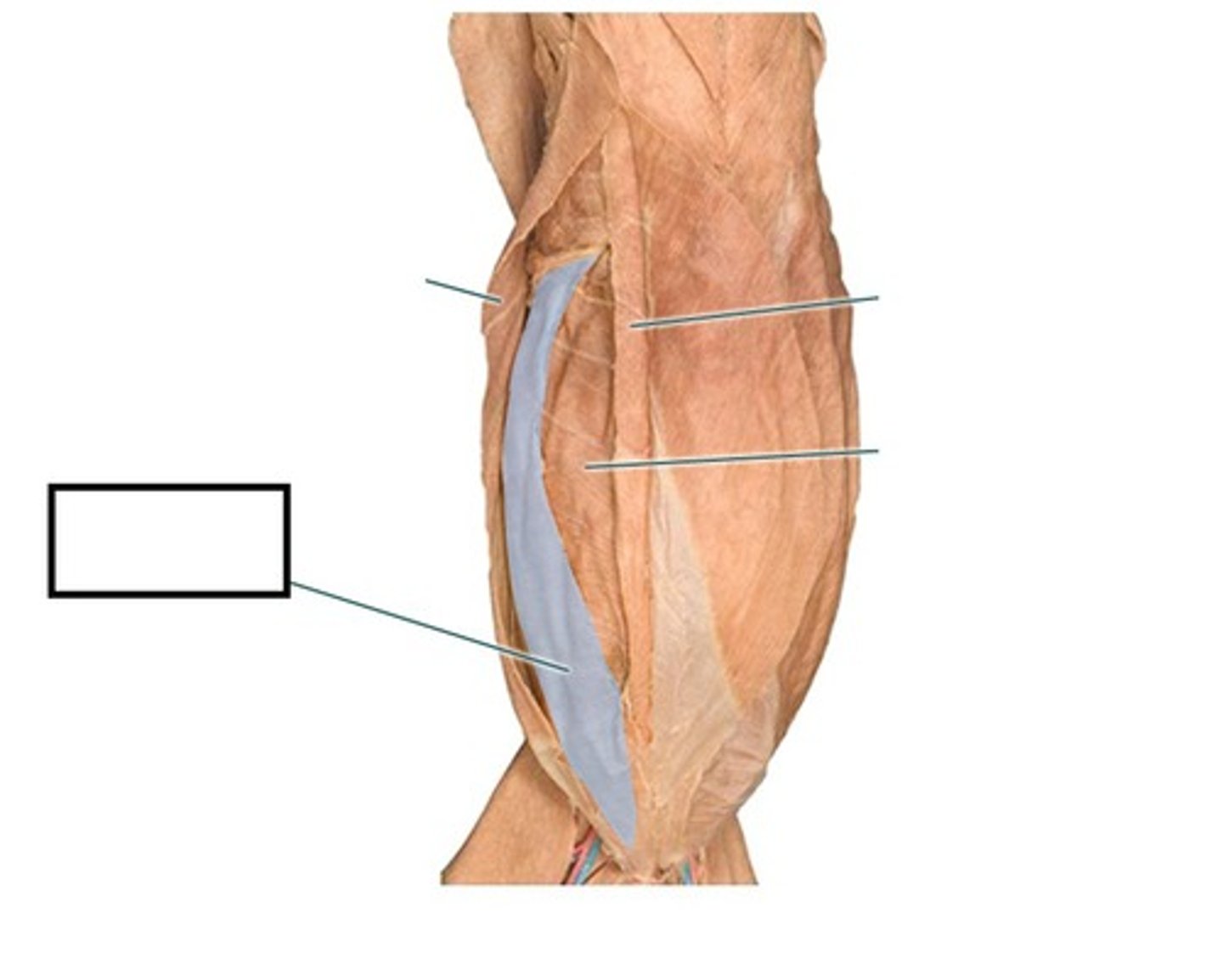<p>name this muscle</p>