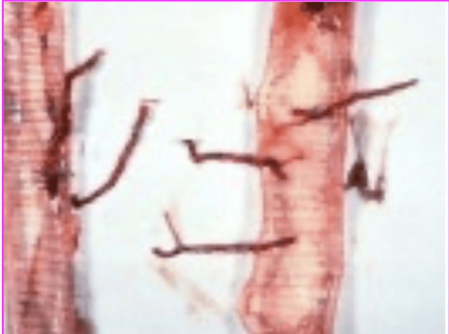 <p>what is this species in the trachea of a bird?</p>