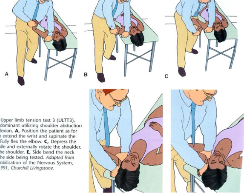<p>Position: Supine</p><p>Examiner: Facing cranially</p><ul><li><p>Shoulder girdle depression (proximal hand depresses shoulder and thigh is used to block the shoulder)</p></li><li><p>Shoulder abducted to 90°</p></li><li><p>Elbow flexed to 90° and wrist is neutral</p></li><li><p>Extend the wrist and fingers and pronate the forearm</p></li><li><p>Externally rotate and abduct the shoulder (bringing patient’s fingers towards their ear)</p></li><li><p>Side bend neck away from the side being tested</p></li></ul>