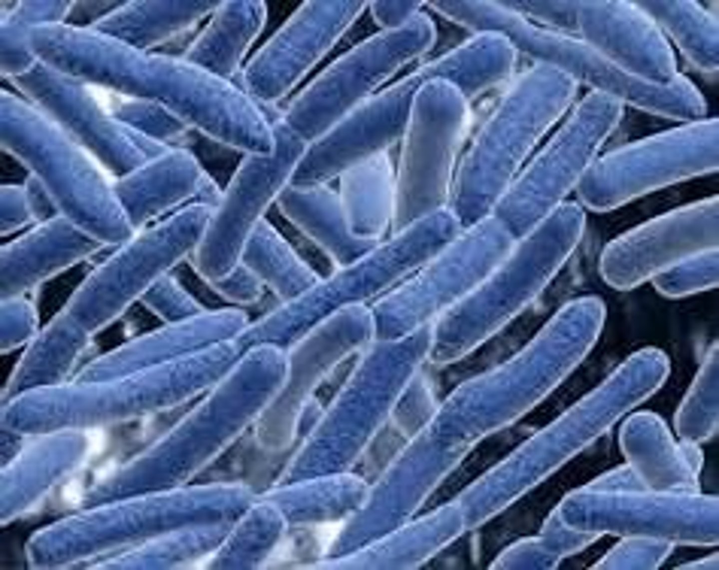 <p>Lactobacillus (probacteria in yogurt)</p>