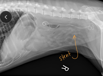 <ul><li><p><span><strong>Subcutaneous ureteral bypass (SUB):</strong> Obstruction, <u>cats&nbsp;</u></span></p><ul><li><p><span>Replaces ureterotomy, pyelolithotomy</span></p></li><li><p><span>Place catheter from renal pelvis to bladder apex</span></p></li></ul></li><li><p><span><strong>Ureteral stent: </strong>for <u>dogs</u> w/ obstruction</span></p></li><li><p><span><strong>Neoureterostomy:</strong> <u>Intramural ectopic uterus&nbsp;</u></span></p><ul><li><p><span>Do a cystotomy</span></p></li><li><p><span>Incise bladder mucosa into ureteral lumen</span></p></li><li><p><span>Create a new stoma then ligate distal portion of ureter</span></p></li></ul></li><li><p><span><strong>Cystoscopic laser ablation: </strong>min invasive for <u>Intramural ectopic uterus&nbsp;</u></span></p><ul><li><p><span>Insise between ectopic ureteral lumen and urethra/bladder</span></p></li></ul></li><li><p><span><strong>Ureteroneocystostomy:</strong> <u>Extramural ectopic ureter&nbsp;</u></span></p><ul><li><p><span>Ligate and transect distal ureter</span></p></li><li><p><span>Spatulate ureteral opening then reimplant ureter into bladder</span></p></li></ul></li></ul><p></p>