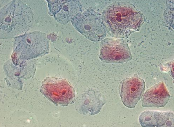 Vaginal stratified squamous epithelial cells.