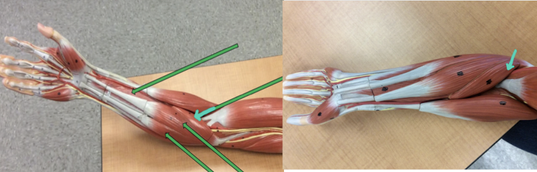 <p>Identify this muscle?</p>
