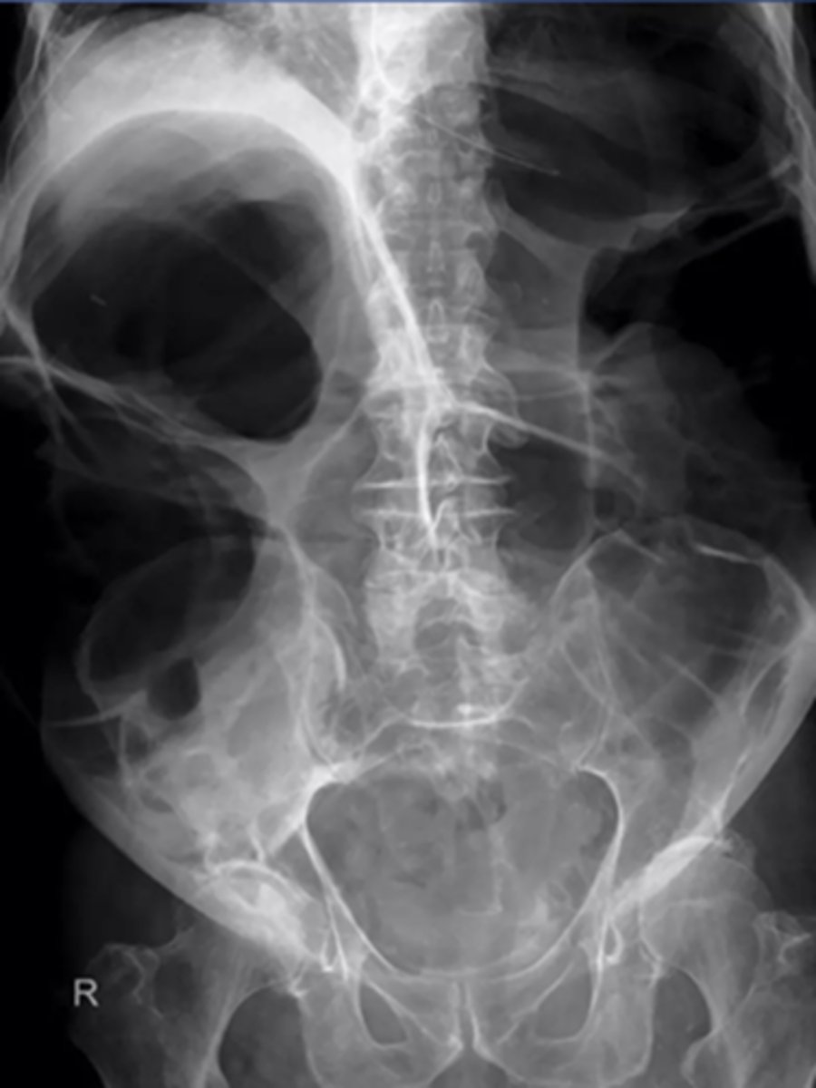 knowt flashcard image