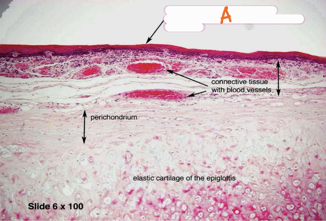 <p>Identify the structure and lining epithelium</p>