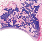 <p>Affects Suffolk and Hampshire sheep. </p><p>Caused by autosomal recessive mutation of FGFR3 gene</p><p>Gross:</p><ul><li><p>long limbs and neck, shallow body, scoliosis/kyphosis of thoracic spine, concave sternum and other sternal deformities</p></li><li><p>Valgus deformity of forelimbs causing knocked-kneed appearance</p></li></ul><p>Histo:</p><ul><li><p>abnormal ossification centres in bone developed by endochondral ossification</p></li></ul><p></p>