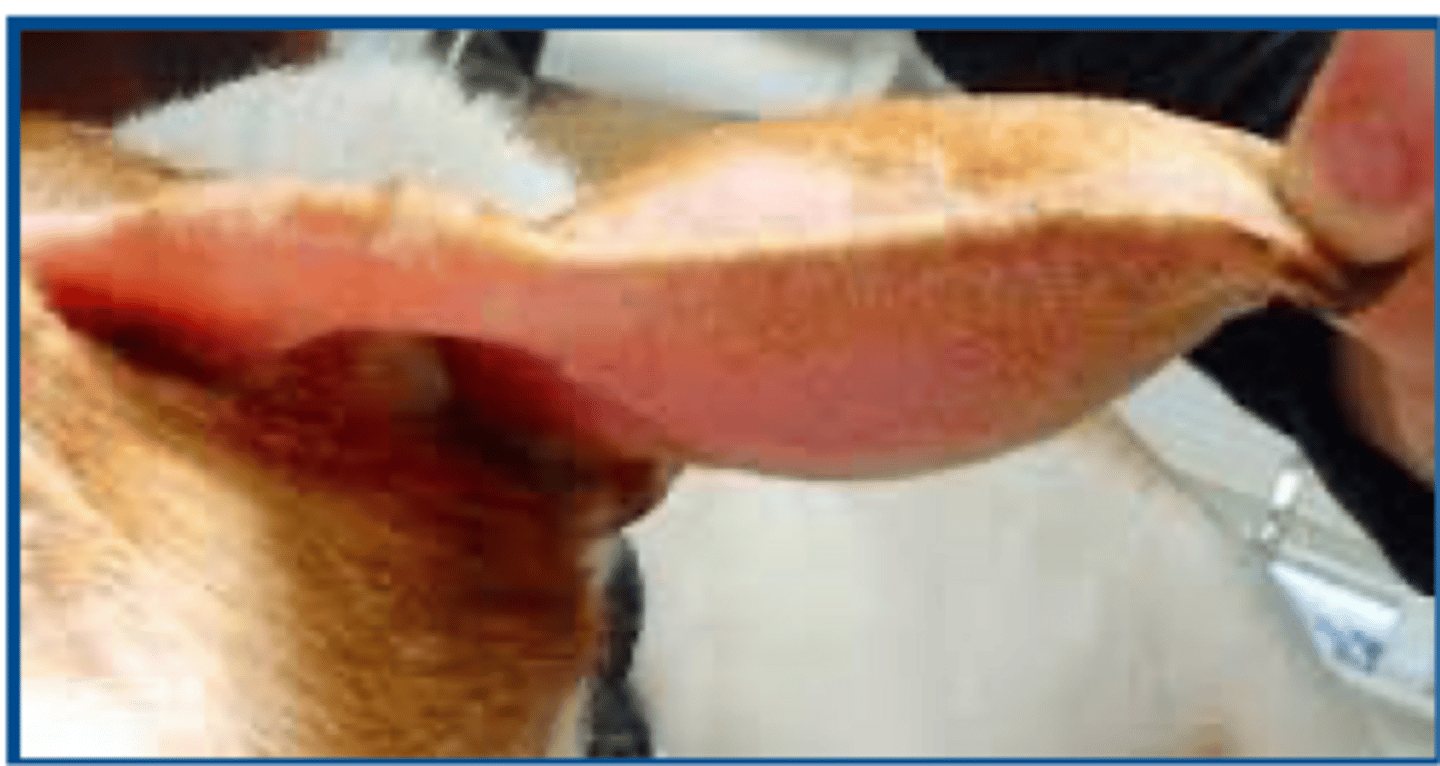 <p>what condition is shown here</p>