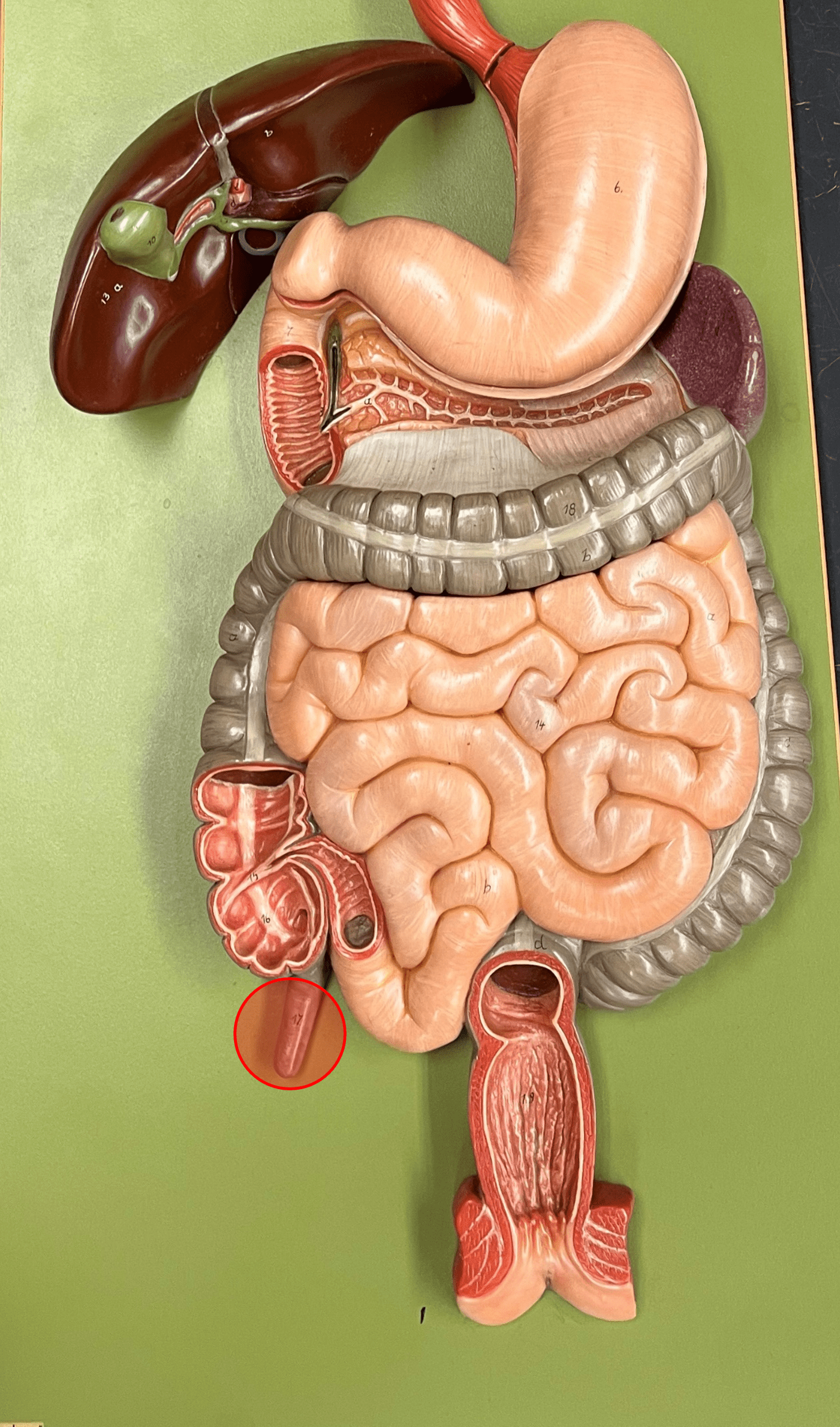 • Part of the cecum.

• A slender appendage extending from the medial wall of the cecum.