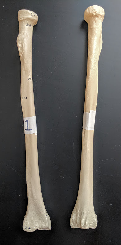 <p>Name this bone</p>