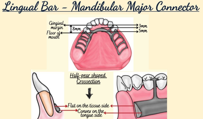 <p>describe the lingual bar</p>