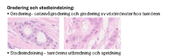 <p>Gradering – cellnivå och växtmönster; Stadieindelning – spridning och utbredning</p>